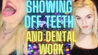 SHOWING OFF TEETH AND DENTAL WORK