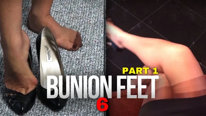 Fetish207 - Foot Fantasies, Bunion Feet 6, Part 1