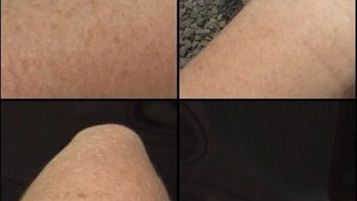 Scarlet's Arm Hair