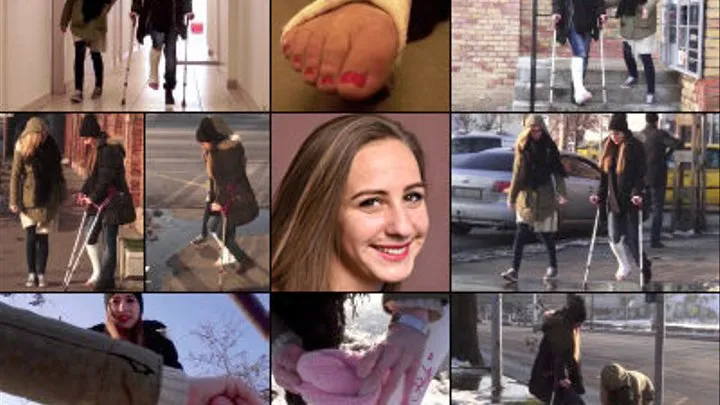 Lois SLWC Crutching Snow Toes in Public with & Without Cast Sock