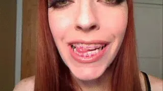 Cum Countdown on my Braces