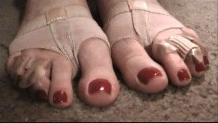 Medical toes 2