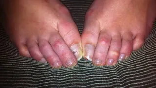 NATURAL RAW TOES - PHOTO VIDEO