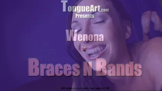 Wenona Braces N Bands 30fps