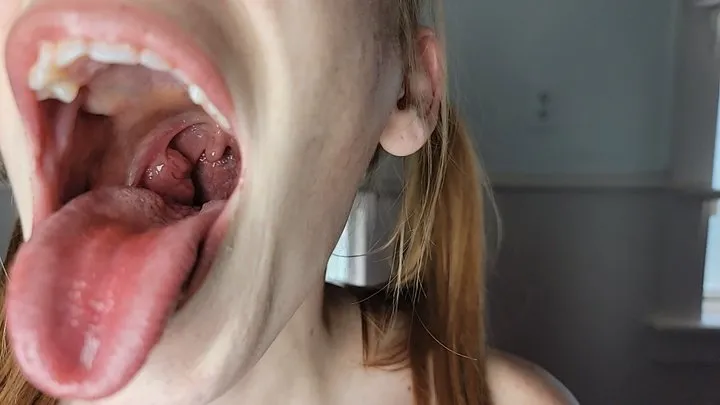 Riann Nova "Tonsil SlideShow"