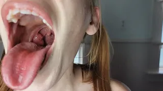 Riann Nova "Tonsil SlideShow"