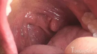 Baile Check My Tonsils