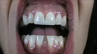Teeth Marks 4 Tootsy