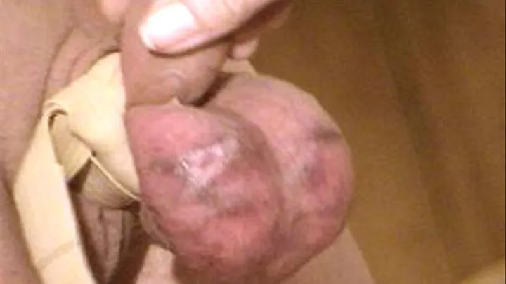 Billy's Welted and Brused Balls - Full Length