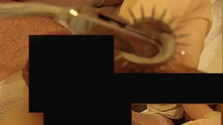 Guest clip: Dr. Mausi The needle wheel Part 2
