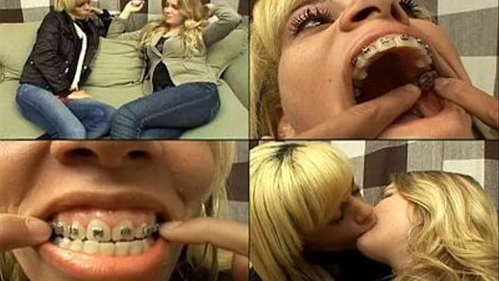 HOT KISSES VOL # 93 - MOUTH WITH DENTAL APPAREL - NEW MF 2010 - CLIP 1 exclusive