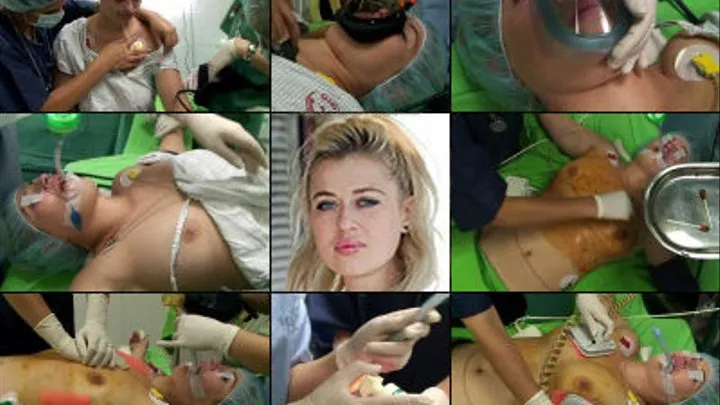 Irina Chest Surgery, CPR, Resus, ET, Respirator