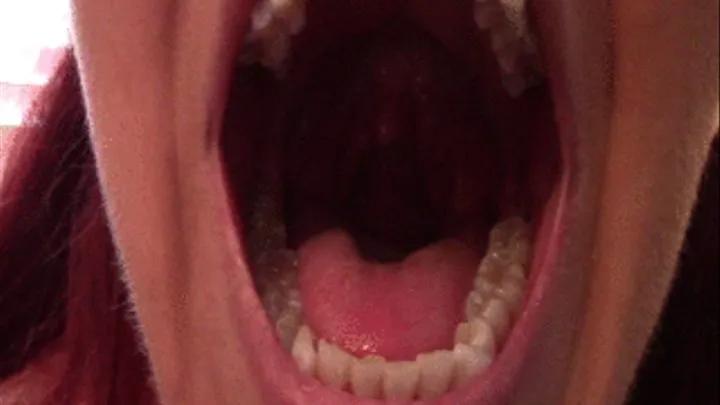 Views Inside Mouth and Throat--10 8 14--MVI 6398