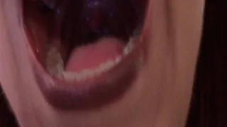 Uvula and Mouth Close Ups--7 31 14--MVI 6158