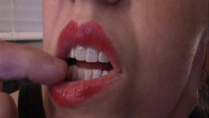 Lip Veins on Bottom Lip--9 5 14-- MVI 6232