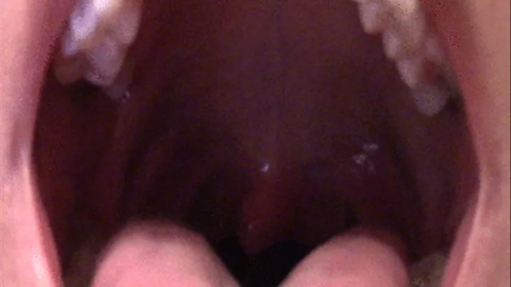 Tongue and Uvula Views with Moaning Sounds--6 20 14--MVI 6029