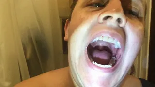 Wide Open Mouth: Wiggling Uvula with Flashlight- 12 2 20