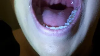 Uvula Close Ups --4 15 20--214 7218 x264