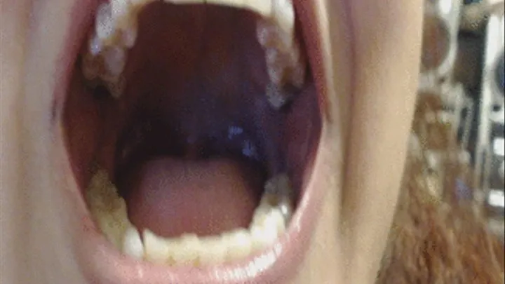 Teeth and Mouth --3 3 17--Video 345