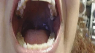 Teeth and Mouth --3 3 17--Video 345