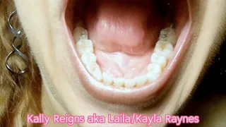 Close Up Mouth and Teeth -Kodak Macro Lens- 117 2539