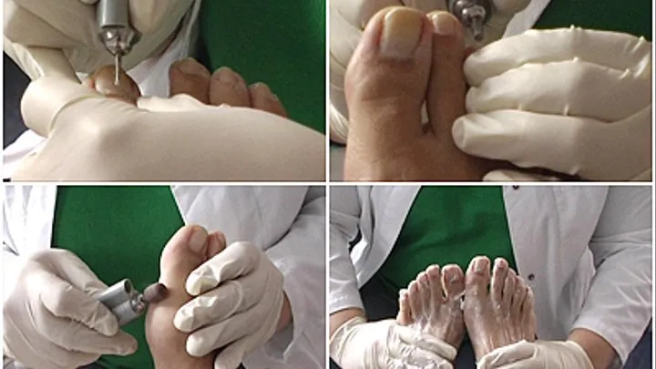 Treatment by a podiatrist...