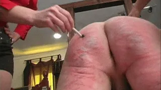 Extreme Caning