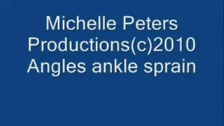 Angel ankle sprain