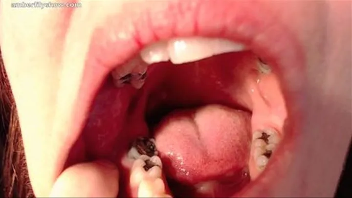 Lips Teeth Tongue Throat
