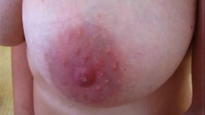 Nipple close up BROADBAND