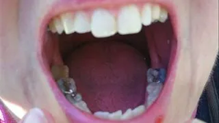 Teeth Fetish Video
