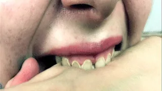 Bad Teeth of doll