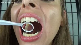 Ambers second mouth clip