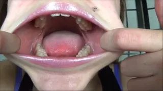 Ashton Monroe's mouth revisited