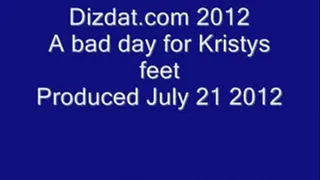 A bad day for Kristys feet