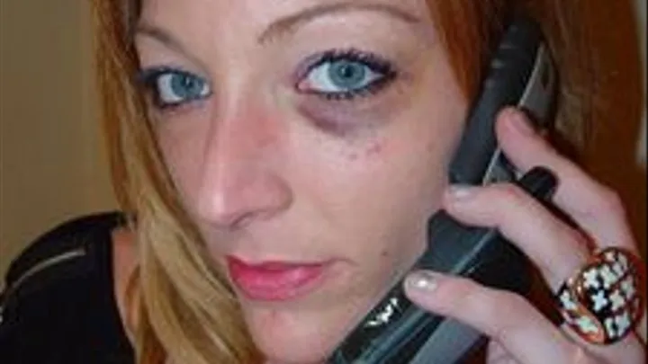 Lyrica's Black Eye