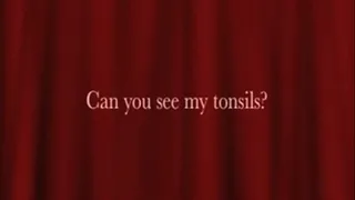 Can you see my tonsils?