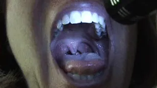 Inside My Mouth