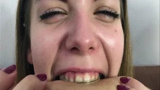 Klaras Braces First Time Bite