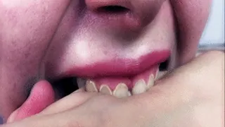 Bad Teeth of doll - Art 2