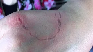 2 Clips - 2 Girls Bites - Mix