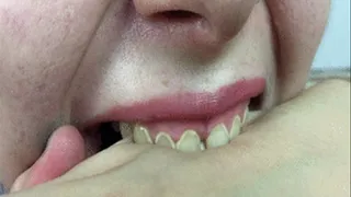 Bad Teeth of doll