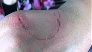 2 Clips - 2 Girls Bites - Mix