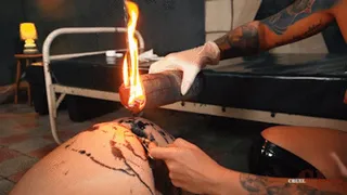 Hot wax into asshole