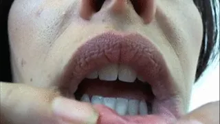 Examine my Mouth