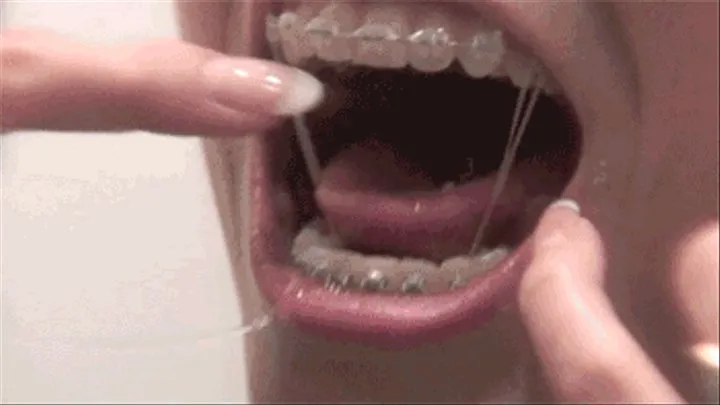 Teeth Brushing with Braces