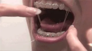 Teeth Brushing with Braces