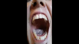 Showing my mouth 002