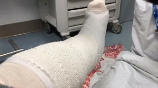 Old Cast Removal and New SLWC Application