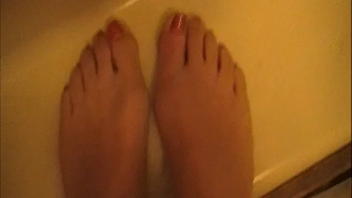 My Swollen Foot